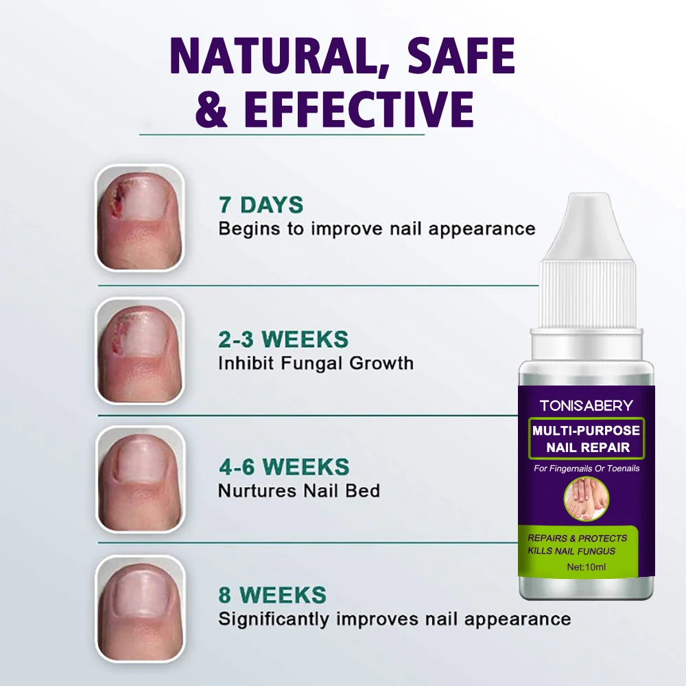 Regenerate Your Nails With 10 Ml Of Grey Nail Restoration Solution Buy Fungal Nail Treatments