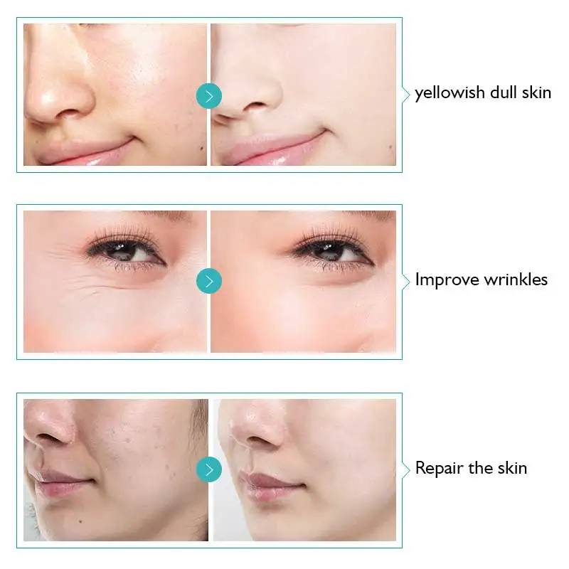 Swiss Apple Stem Cell Serum Plant Natural Reduce Aging Signs Wrinkles Discoloration Restore Elasticity to Get Youthful