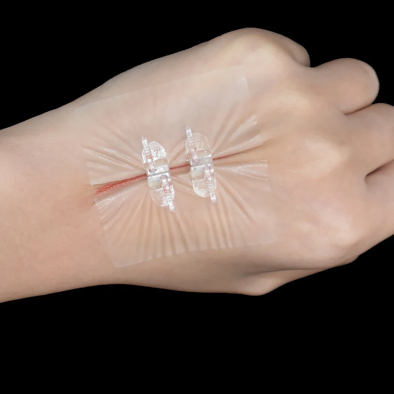 Wound Device Zip Wound Closure Wound Splice Closure