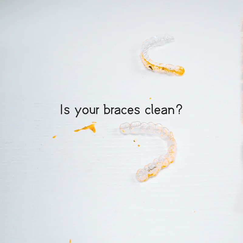 Ykl Personal Care Orthodontic Mouth Guard Cleaner Remove Stains