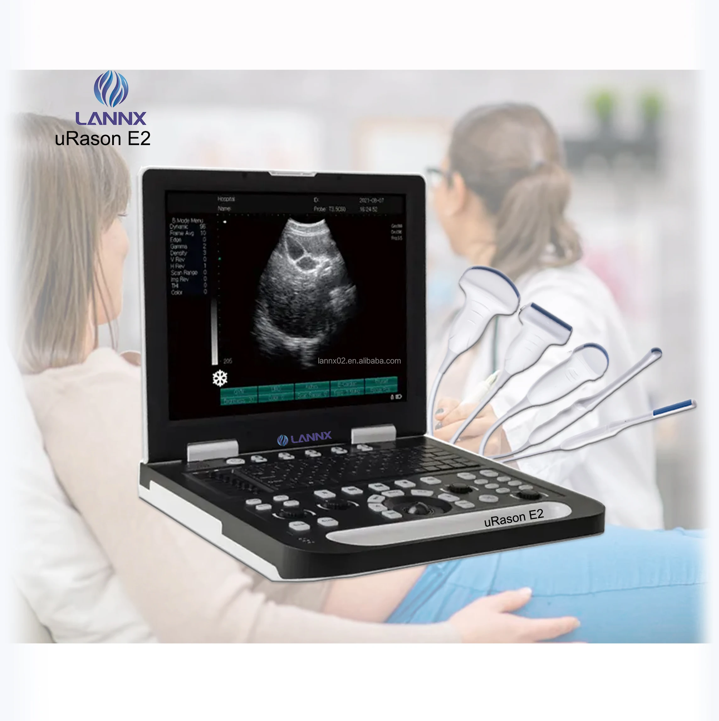 Lannx Urason E2 Clinic Handheld Ultrasound Imaging Detector Machine ...