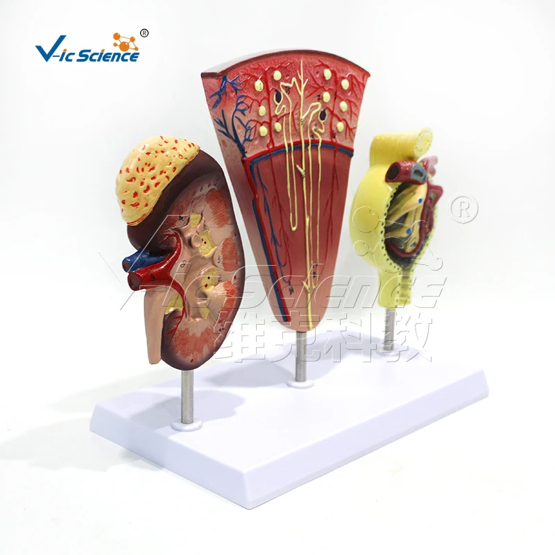 Почечная анатомическая модель нефроновая гломерулярная