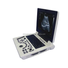 Medical Ultrasound Laptop 3D Ob Gyn BW Laptop Ultrasound
