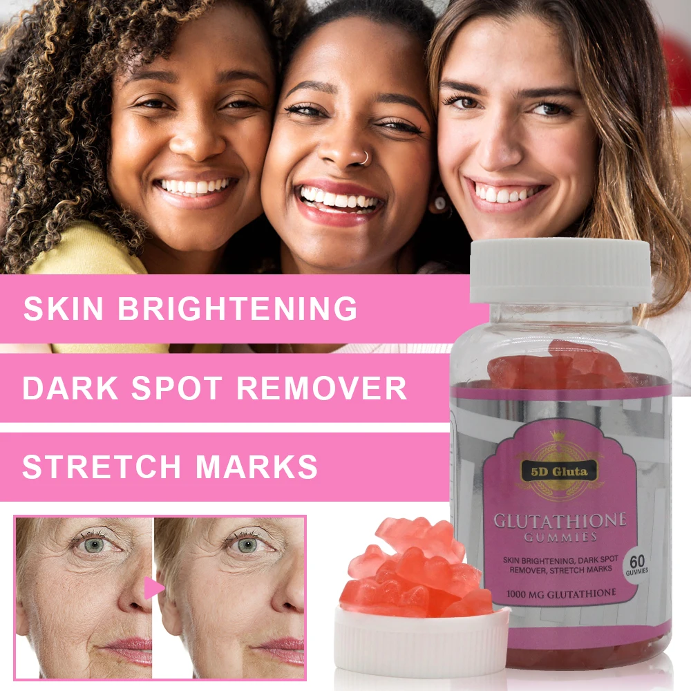 is glutathione good for vitiligo Effective Vitiligo Treatment in Chennai is glutathione good for vitiligo Effective Vitiligo Treatment in Chennai