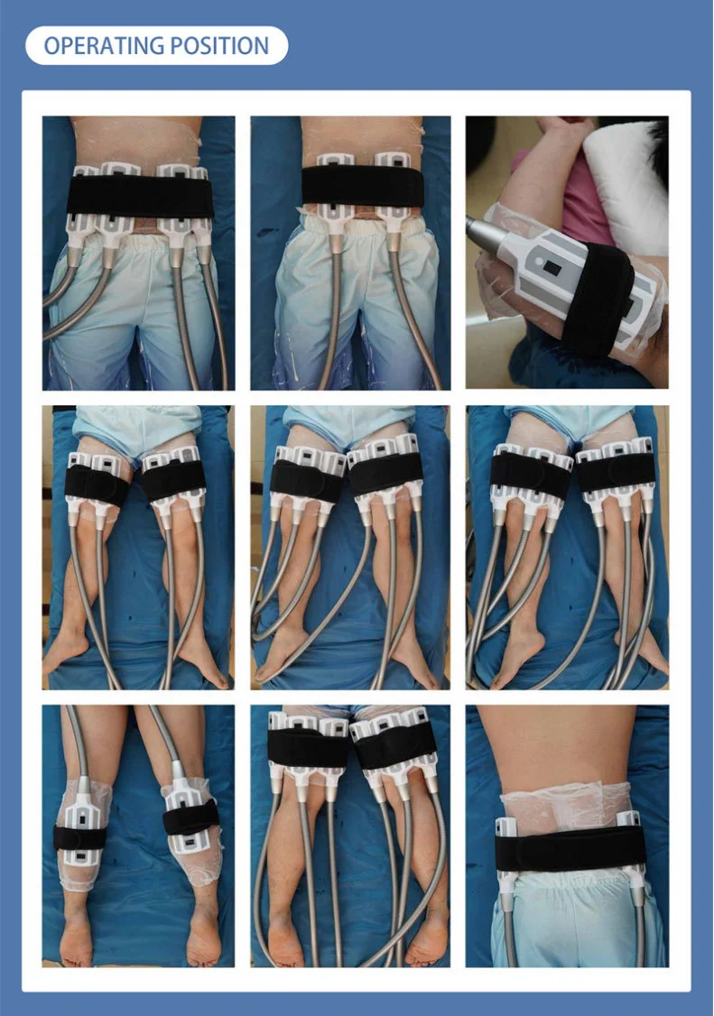 8 Pads Cryo Lipolysis Cryotherapy Fat Freezing Body Sculpting Machine 10 Discover the professional 8 Pads Cryo Lipolysis Cryotherapy Machine for non-invasive fat freezing, body sculpting, slimming, and advanced cryotherapy contouring treatments for salons and med spas. 8 Pads Cryo Lipolysis Cryotherapy Fat Freezing Body Sculpting Machine