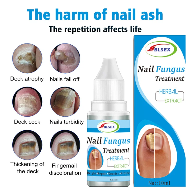 10ml Nail Fungus Treatment Antifungal Nail Solution Ringworm Clear ...
