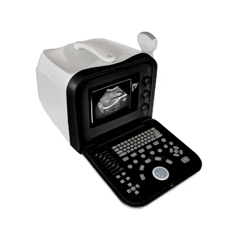 KR-1288V Hot selling black and white ultrasound full digital B-type scanning instrument hospital diagnostic testing equipment