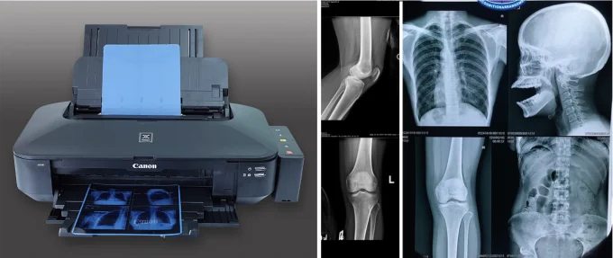 Hoge helderheid medische röntgenfilm FUJI DIHT 14*17in Laser Dry Imaging Film 4