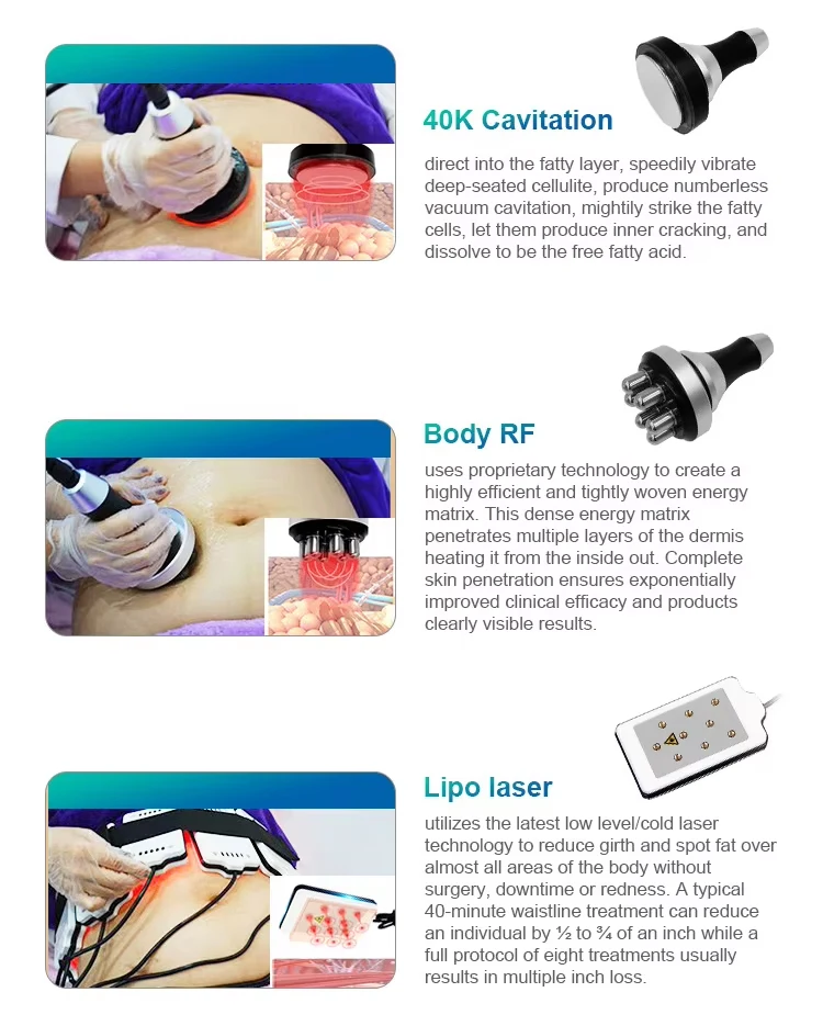 <p data-pm-slice="1 3 []">The Cryolipolysis and Body Slimming Machine is a multifunctional body contouring system designed for professional aesthetic salons, Med Spas, and beauty clinics. Combining controlled cooling, 40KHz ultrasonic cavitation, 6-polar radiofrequency (RF), and laser lipolysis in one platform, it offers multiple treatment modalities for customized body contouring services.</p> The system includes four cryolipolysis applicators—2 large, 1 medium, and 1 small—alongside dedicated cavitation, RF, and laser lipolysis attachments. With adjustable vacuum pressure of 0–80 kPa and a cooling range of -10°C to 10°C, it provides versatile configuration options for professional body treatment protocols. <strong>Key Features</strong> <ul data-spread="false"> <li>Multiple technologies integrated into one body contouring platform</li> <li>Four cryolipolysis applicators in three sizes</li> <li>40KHz ultrasonic cavitation</li> <li>6-polar RF handpiece for body contouring applications</li> <li>Laser lipolysis attachments with specified 100 mW-per-emitter output, subject to manufacturer confirmation</li> <li>Adjustable negative pressure from 0 to 80 kPa</li> <li>Dual-voltage options for different electrical markets, subject to configuration confirmation</li> </ul> Cryolipolysis Body Slimming Machine with Cavitation RF & Laser Lipolysis