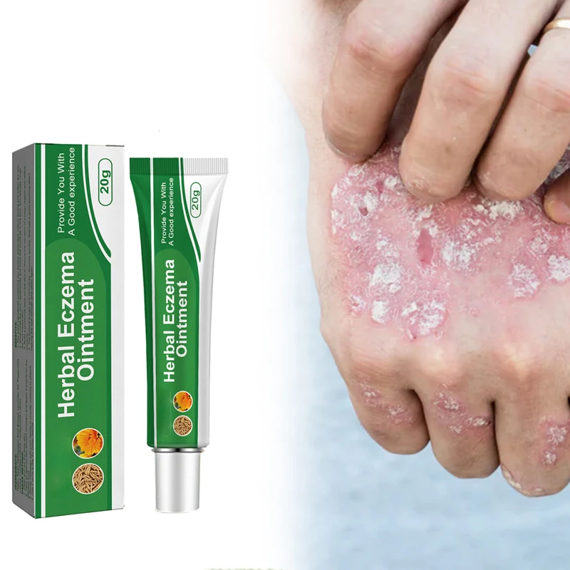 Cari Kualitas Tinggi Perawatan Psoriasis Produsen Dan Perawatan Psoriasis Di Ali - Foto 5