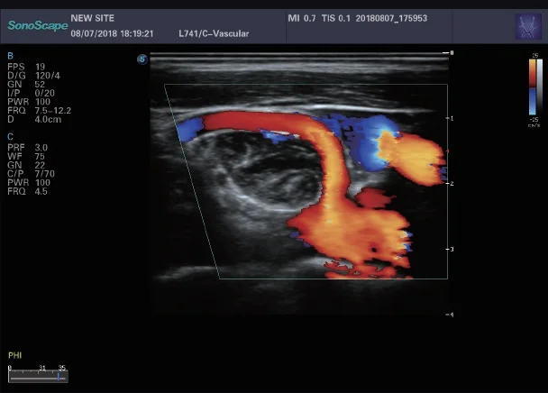 SONOSCAPE P25 Elite 4D Echo Machine Medical Ultrasound Scanner for Obstetrics Gynecology Pediatrics Urology