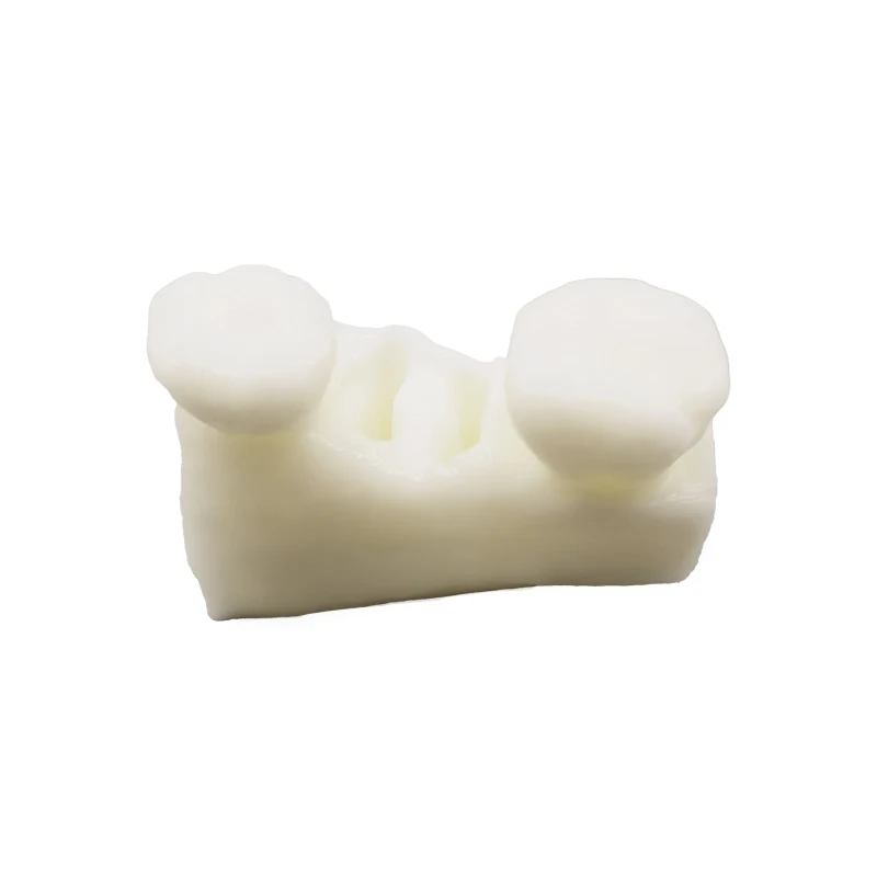 Customized Dental 3D Printed SLA Grade Tooth Model Photosensitive Resin Typodont Laser Machining