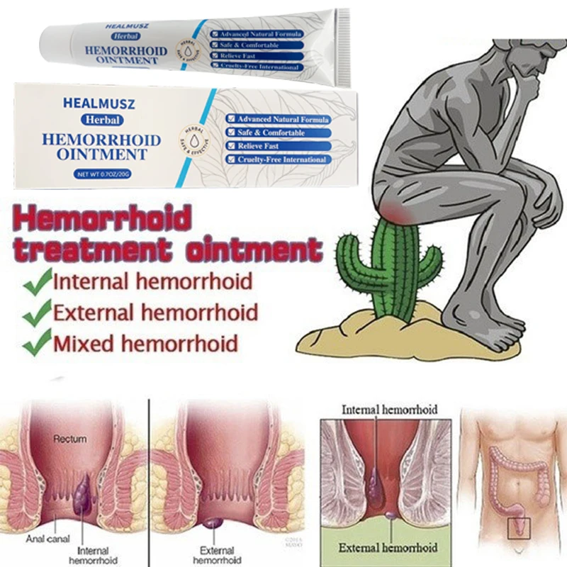 Hemorrhoids Ointment Anal Crack Internal External Piles Anal Fissure Analgesic Chinese Herbal Cream 20g