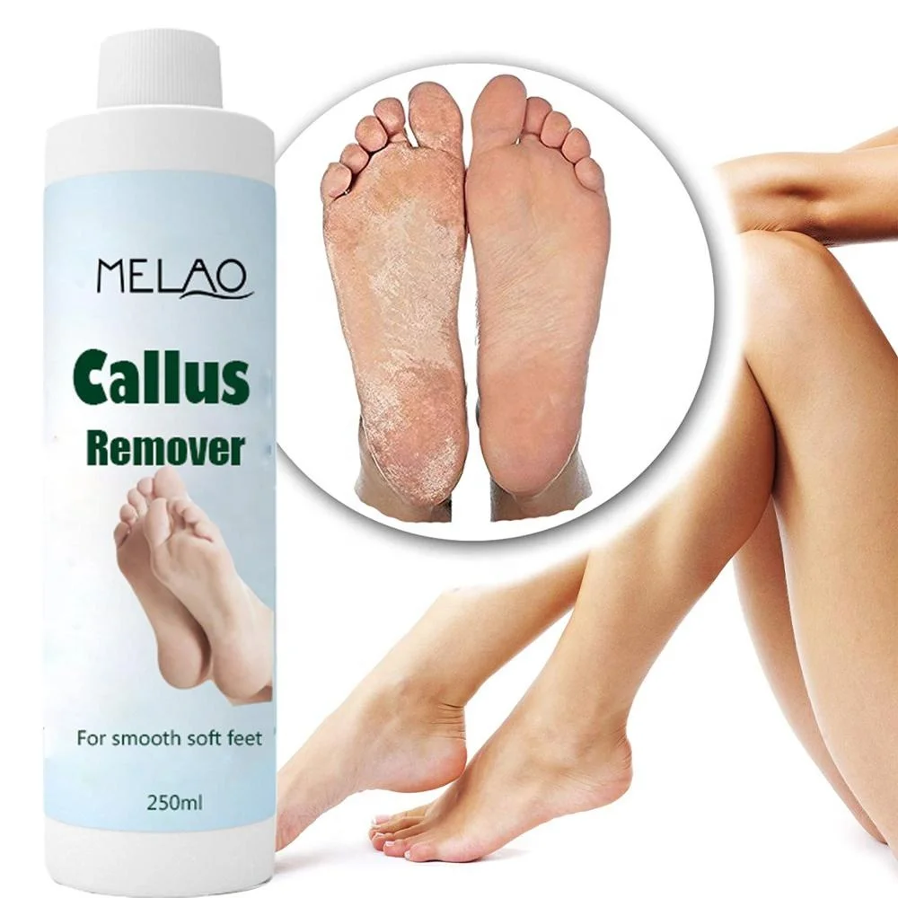 Foot Care Remover Dead Skin Eliminator And Foot Exfoliator Professional Strength Callus Remover Gel