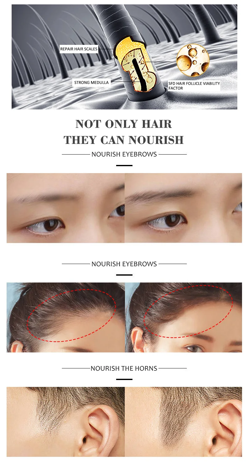 Hot Selling Dissar Organic Hair Loss Growth Oil Natural Regrowth Hair Oils for Hair Growth