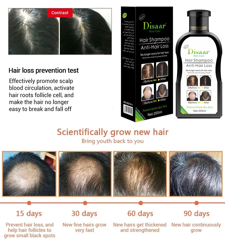 Disaar Anti Hair Loss Shampoo Organizer Men and Women Natural Ginger Growth Hair Shampoo for Damage Hair