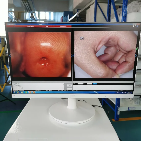 Porno gilosni parchalab tashladi