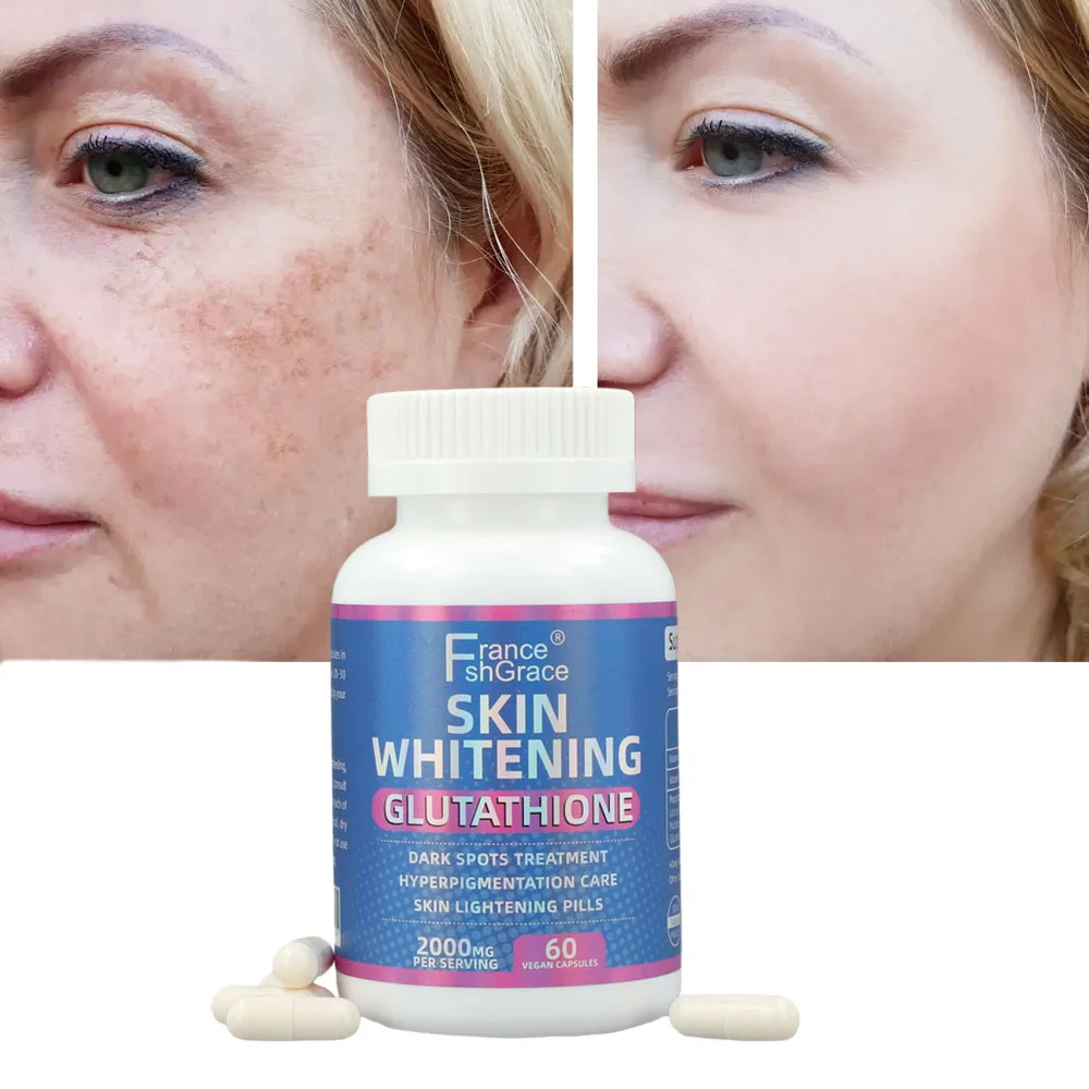 skin whitening glutathione 2000mg Amazon.com: Glutathione Whitening Pills - 120 Capsules 2000mg Glutathione -  Effective Skin Lightening Supplement - Dark Spots, Melasma & Acne Scar  Remover, Hyperpigmentation Treatment main image 1