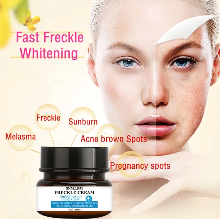 SNMLPM 30g Freckle Cream Deep Moisturizing Melanin Freckle Cream Dark Spots Acne Scar Face Whitening Cream