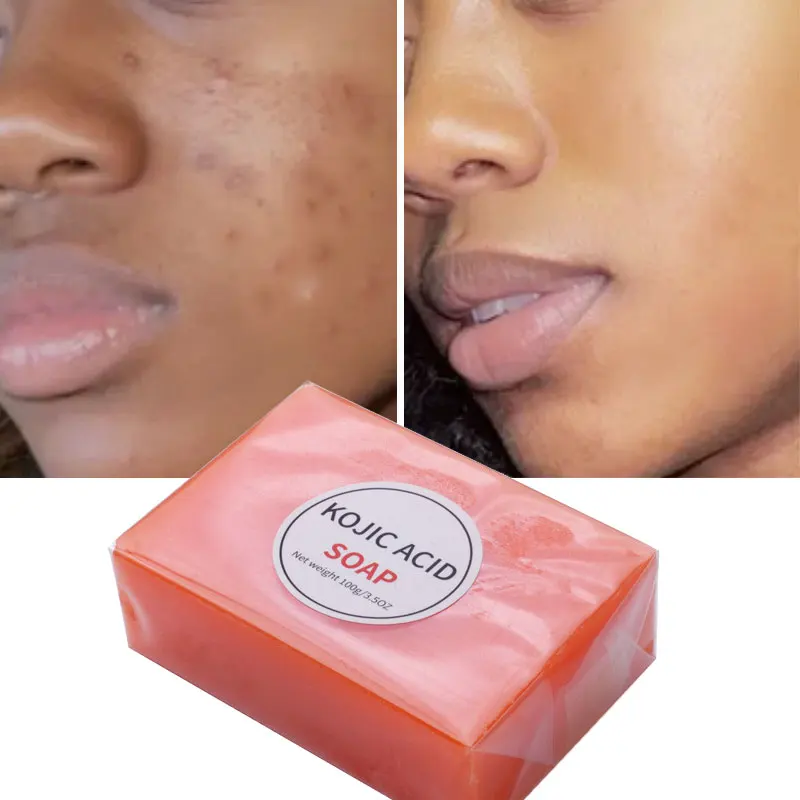Turmeric Kojic Acid Soap Face Anti Acne Whitening Kojic Acid Gluta Thione  Toilet Soap Skin Brighten Bleaching Handmade Bath Soap