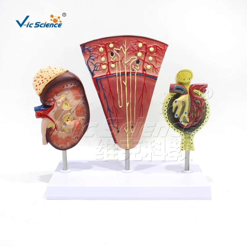 Почечная анатомическая модель нефроновая гломерулярная