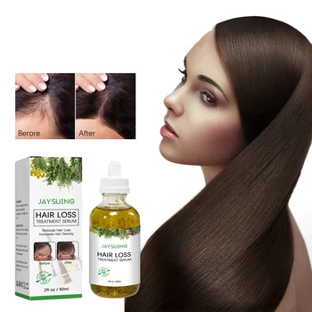 custom logo private label essence hair growth massage scalp hair tonic