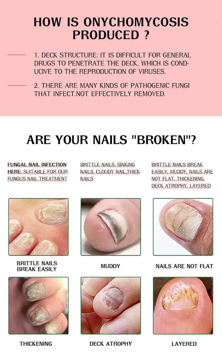 Sample+oem/odm Foot Fungus Nail Brush Kit 10ml/bottle Glass