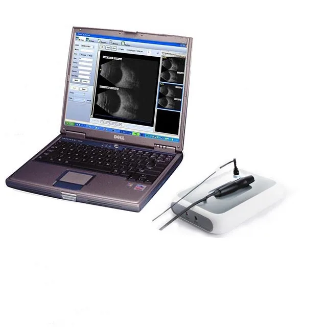 SW-2100 China ophthalmic equipment ultrasound a AB ecobiometry scanner ophthalmology AB Scan