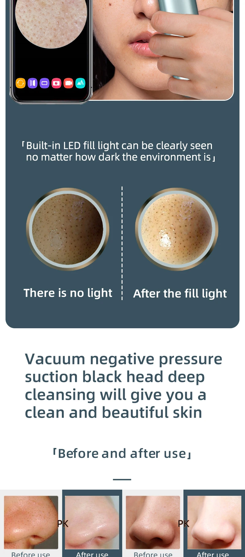 Custom Package Visual Electric Blackhead Remover Vacuum Suction