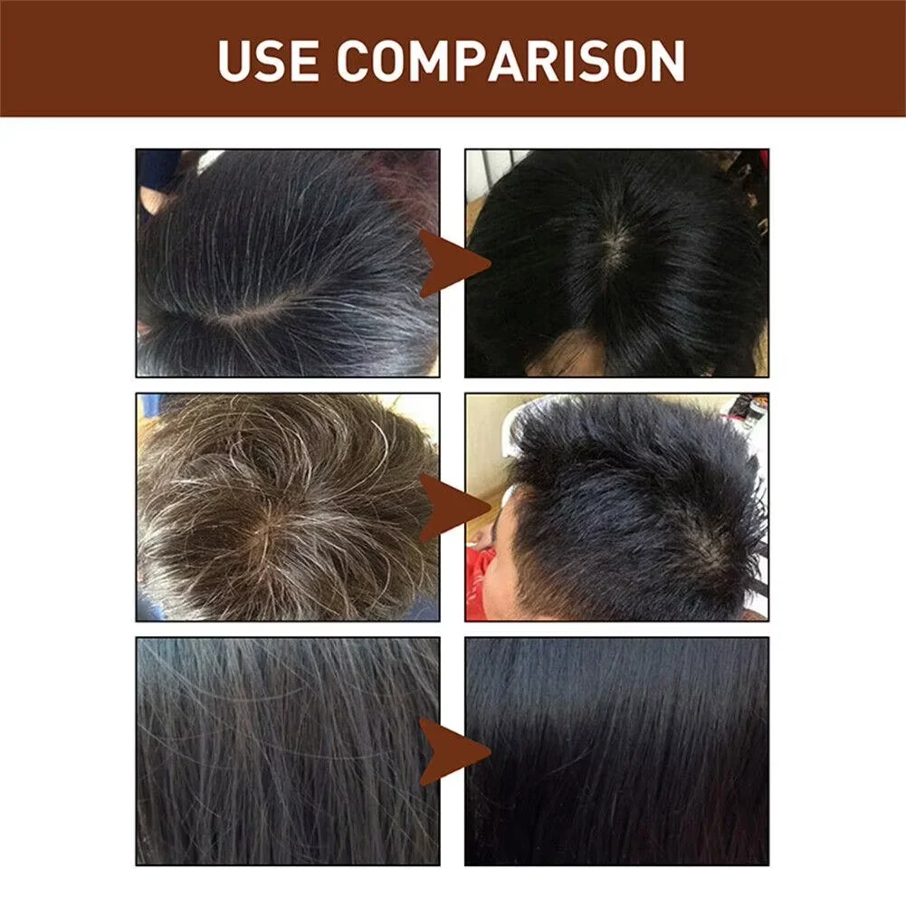 Hot Moisturize Repair Hair/ Hair Growth /Prevent Lost/Anti-Dandruf Polygonum Multiflorum Hair Care Bath Supplies Handmade Soap