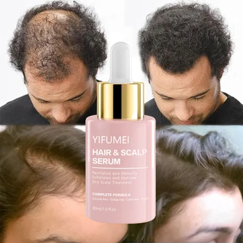 Private Label Hair Growth Treatments Anti Loss Growth Serum Rosemary Hair Oil