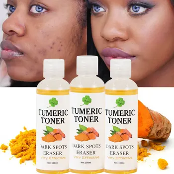 Wholesale Turmeric Toner Dark Spots Eraser Brightening Skin Tone Fades Blemishes Acne Remove Whitening Face Toner