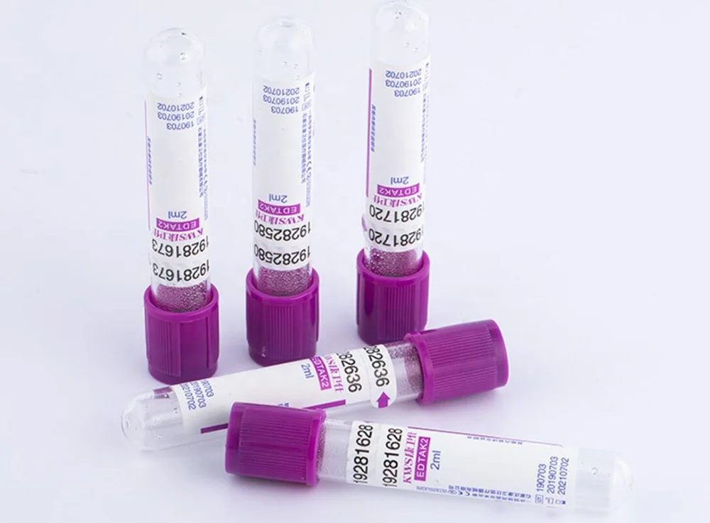 edta 2 vacutainer.jpg