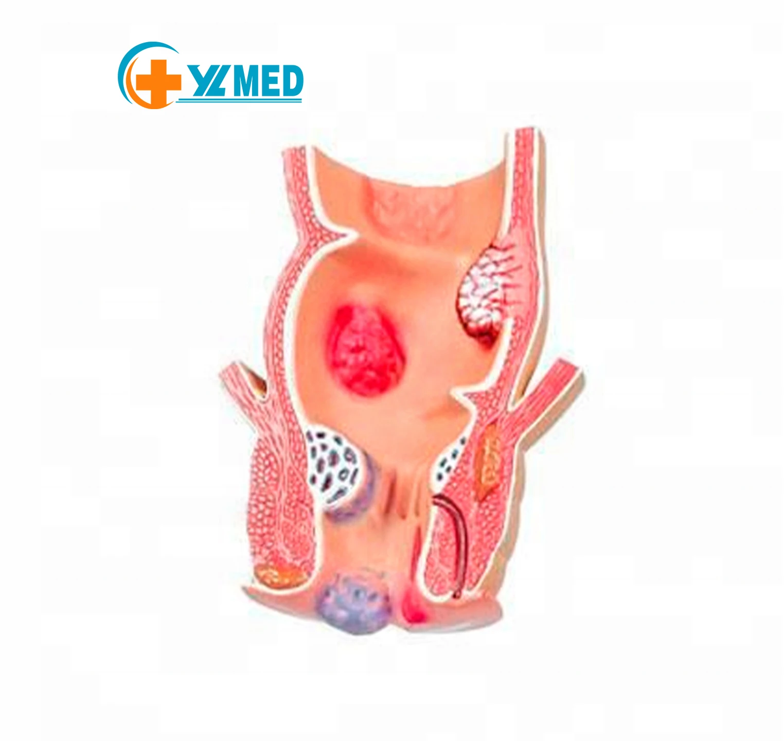 Medical Advanced PVC Enlarge Anatomical Model Pathological Model of Rectum