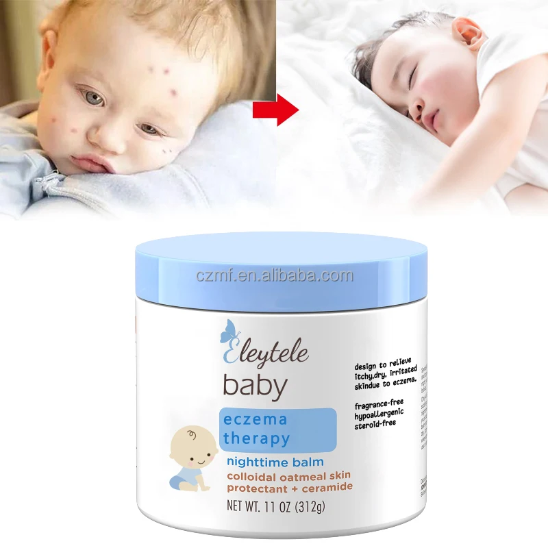OEM Фирменная торговая марка заводская цена Натуральный Детский бальзам успокаивающий экзема подгузник сыпь отбеливающая Крем от экземы