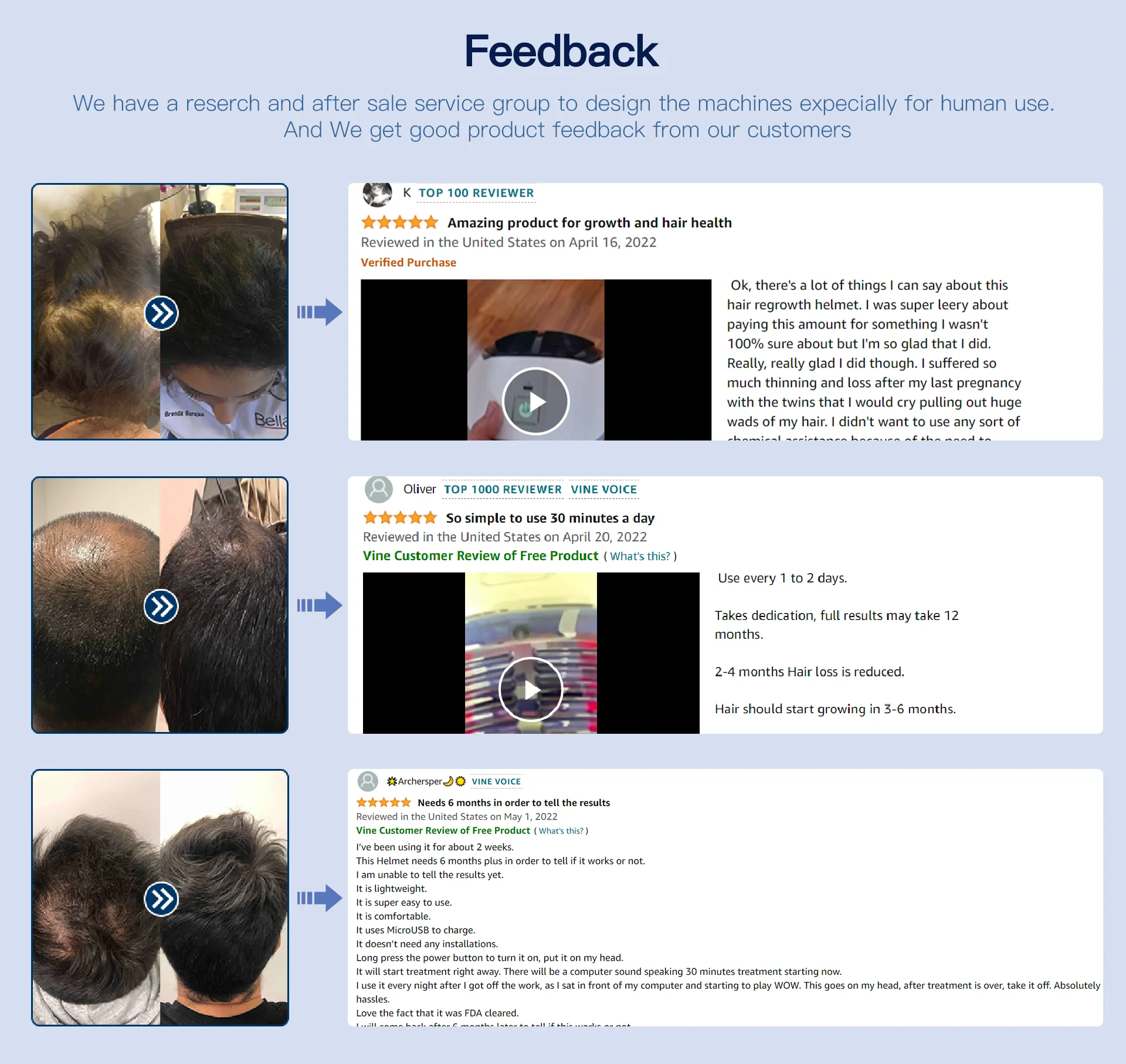 Shenzhen Afkmed Co., Ltd. - Laser Hair Growth Helmet, Laser Hair Growth ...