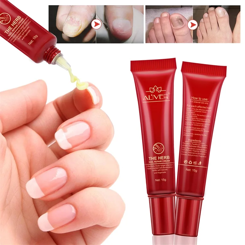 ALIVER Hand Foot Nails Protector Strengthener Cream Anti Fungus Treatment Herb Nail Repair Cream