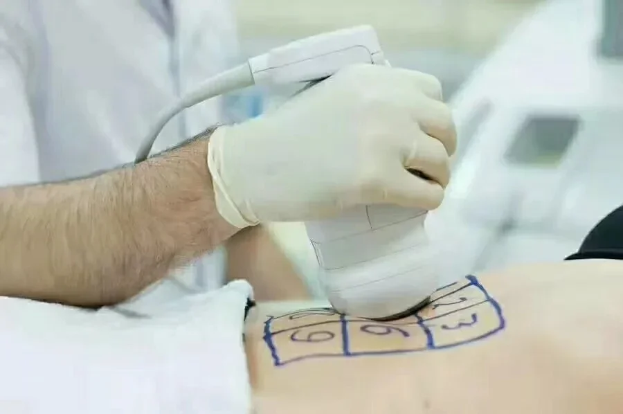 Discover the LipoSonic HIFU Machine for non-invasive fat reduction and body sculpting. Advanced ultrasound technology delivers targeted fat destruction, skin tightening, and visible slimming results for professional clinics and med spas. LipoSonic HIFU Machine for Body Slimming Weight Loss