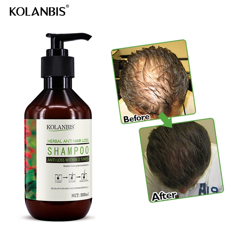 Herbal Shampoo Control Anti Hair Loss Products Treatment For Hair Growth