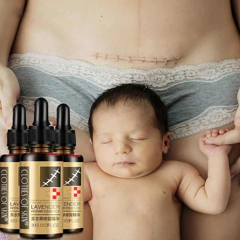 
 Натуральное средство для удаления шрамов, лаванда, 30 мл  