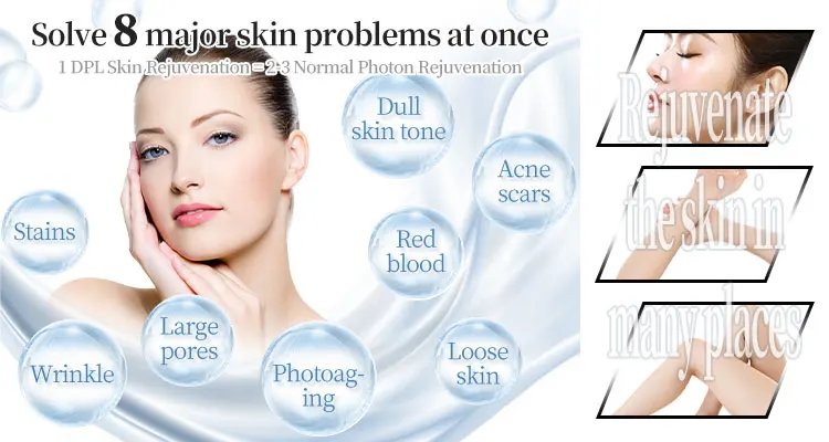 Discover the Black Gold DPL Ultra-Photon Skin Rejuvenation Device, a professional narrow-spectrum light platform designed for pigmentation correction, vascular therapy, acne treatment, and long-term hair reduction for aesthetic clinics and medical spas. Black Gold DPL Ultra-Photon Skin Rejuvenation Hair Removal Device