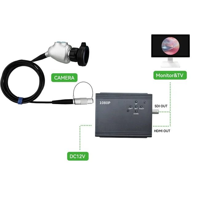 New arrival  2.8 so ny cmos 1080P 60fps 3G SDI  ENT Endoscopic HD Camera