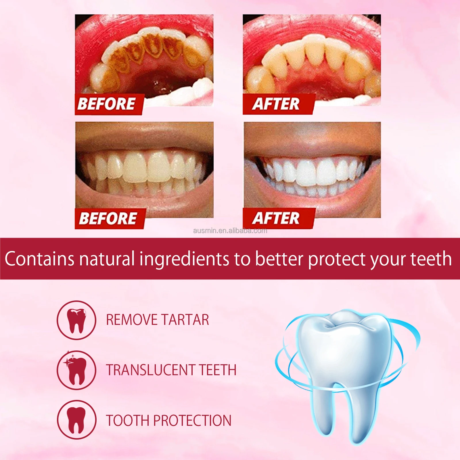 Probiotic Toothpaste Sp4 Brightening Whitening Toothpaste Protect Gums Fresh Breath Mouth Teeth