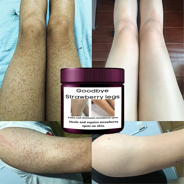 Private Label 7days Strawberry Legs Cream Fades Strawberry Spots Skin  Smooth Strawberry Legs Exfoliating Cream Buy Exfoliating Cream,Legs