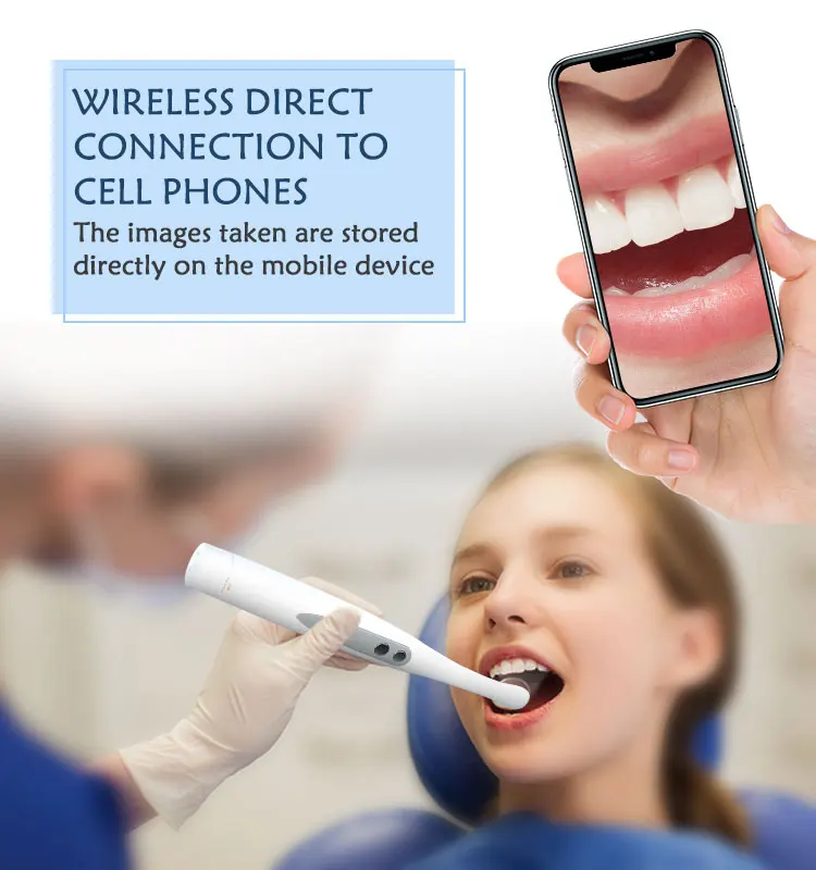 5g Wireless Usb Intra Oral Camera Wifi Hd 13mp Dental Oral Intraoral