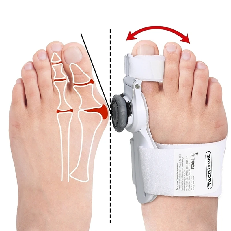 OEM Custom Toe Separator Bunion Corrector Hallux Valgus Orthopedic Braces Toe Correction of Night Valgus Corrector