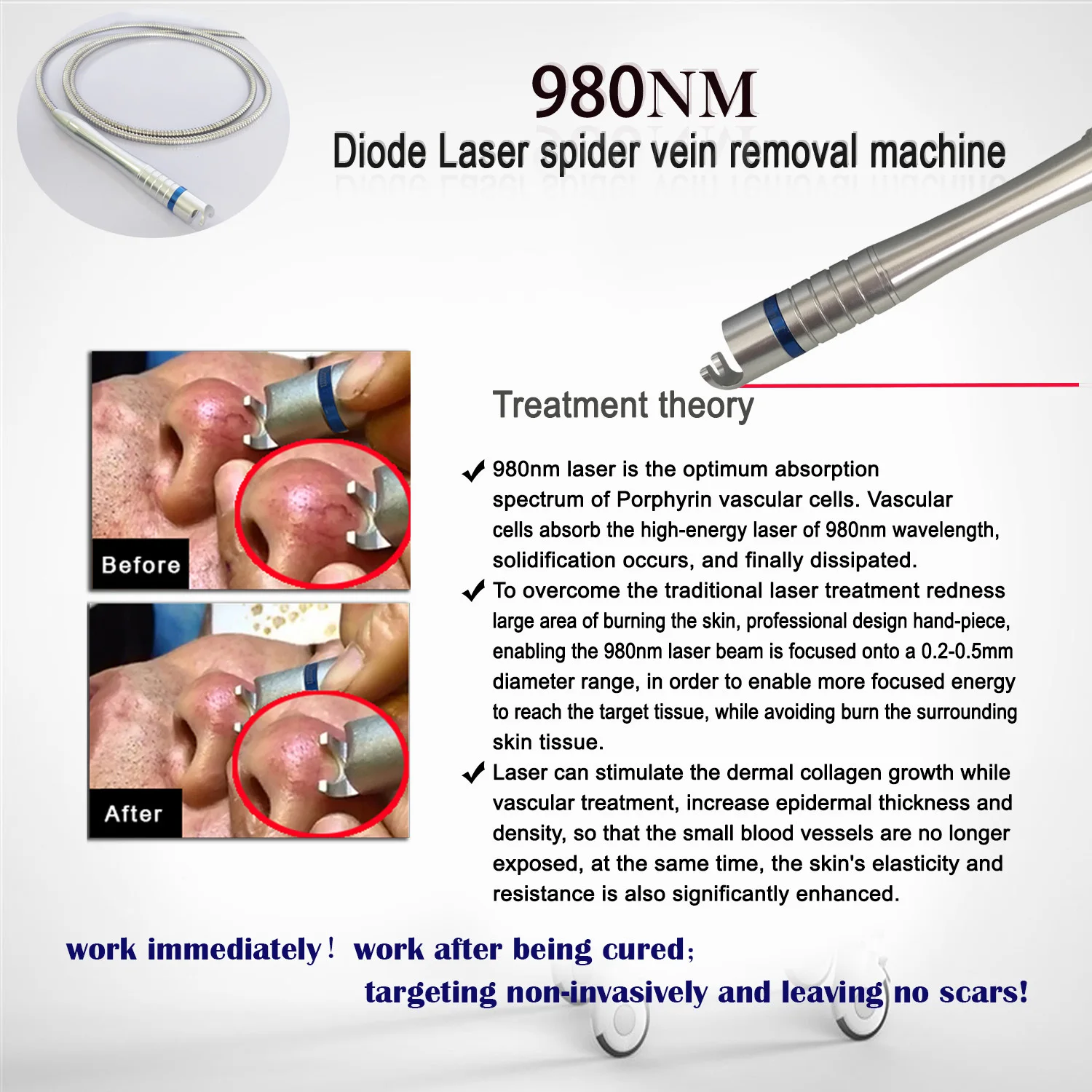 CE Approved Vascular Removal Machine Spider Vein Removal 980nm Diode Laser Machine Portable with Ice Hammer