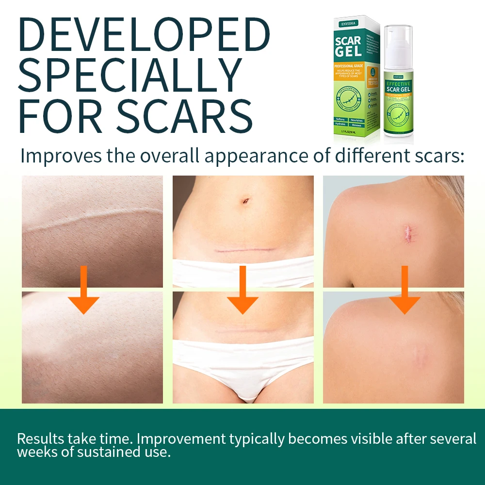 Organic Silicone Scar Removal Gel for Surgical Scars Face Body Leg Burns Acne C-Section Stretch Marks Keloids Scar Treatments