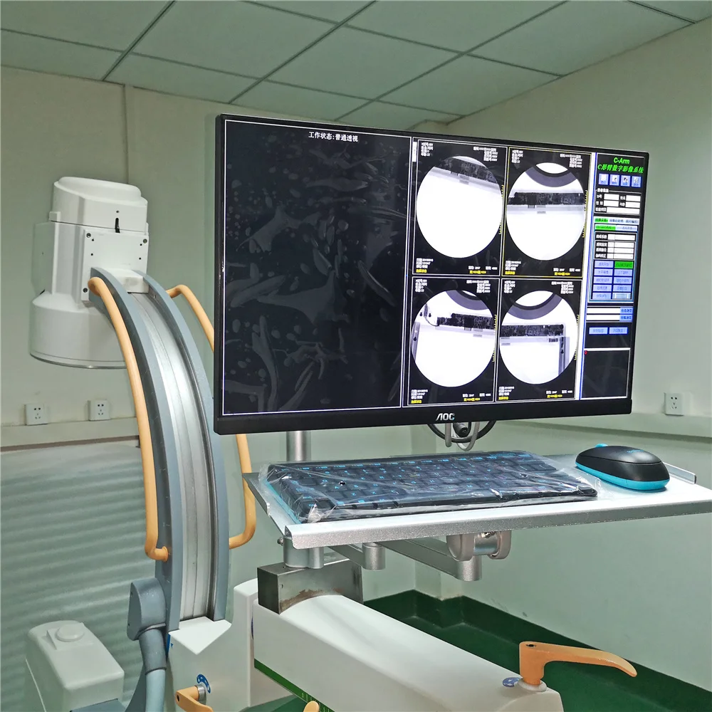 China Cheap Price High Frequency Portable Mobile c Arm System X Ray Machine