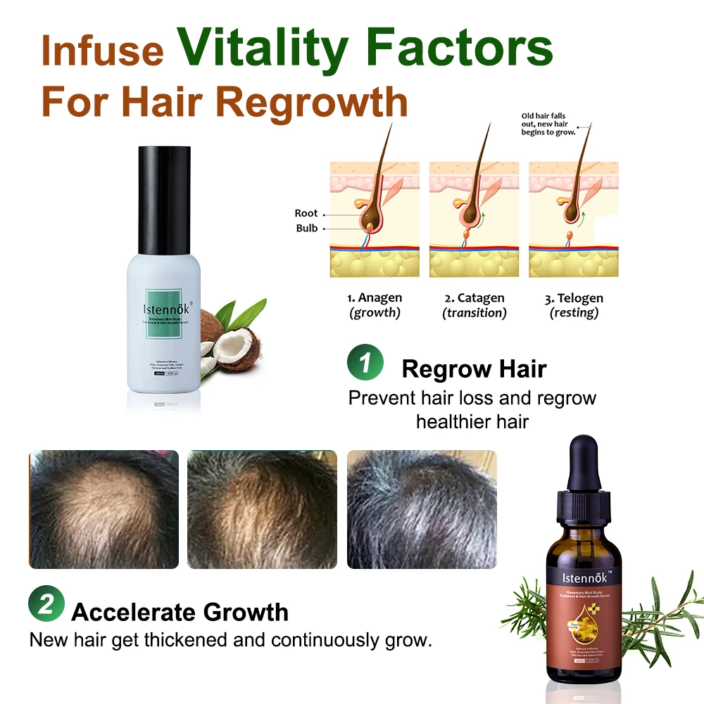 Восстанавливающая против выпадения восстанавливающая Мятная масляная сыворотка Elixirs для кожи головы от фирменного бренда, имбиря, розмарина, роста волос, 30 мл